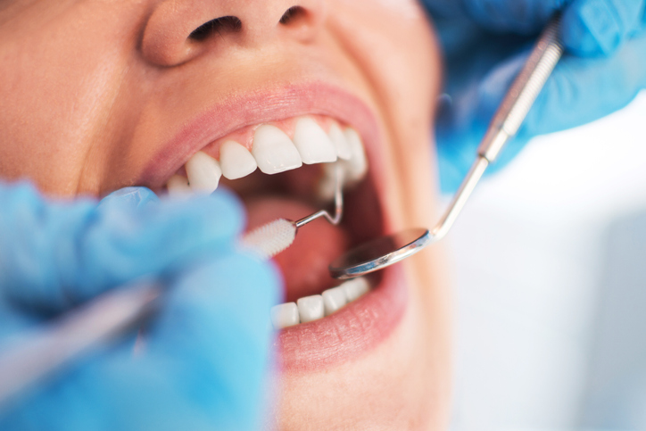 higiene dental tratamiento periodontal