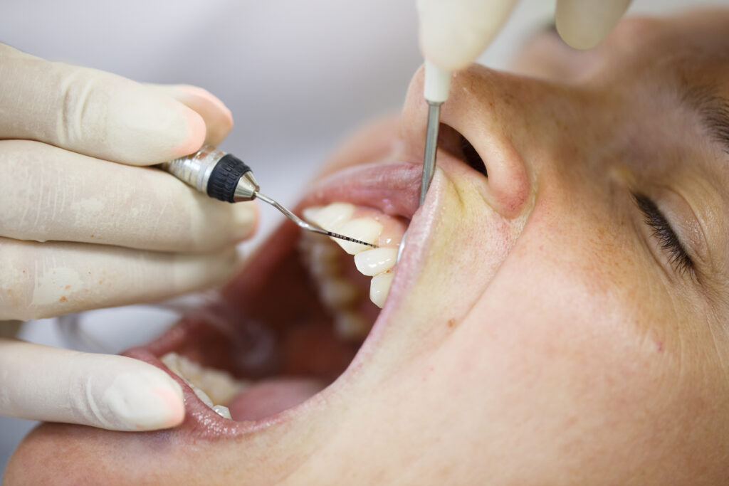 Tratamiento periodontal