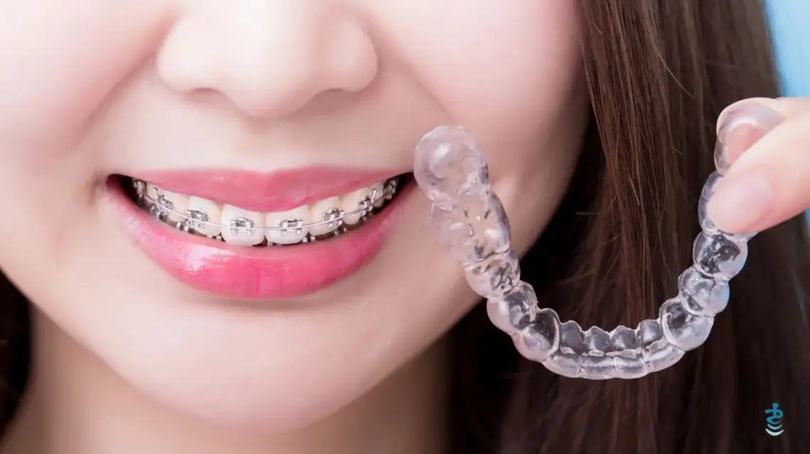 Ortodoncia invisible o brackets: ¿Qué es mejor para ti?. Descubre las diferencias entre la ortodoncia invisible (Invisalign) y los brackets tradicionales. Ventajas, precios y cuál se adapta mejor a ti.