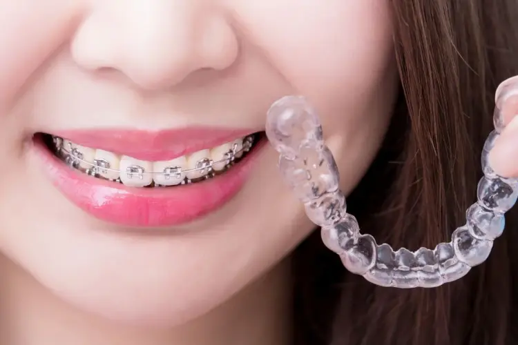 Ortodoncia invisible o brackets: ¿Qué es mejor para ti?. Descubre las diferencias entre la ortodoncia invisible (Invisalign) y los brackets tradicionales. Ventajas, precios y cuál se adapta mejor a ti.