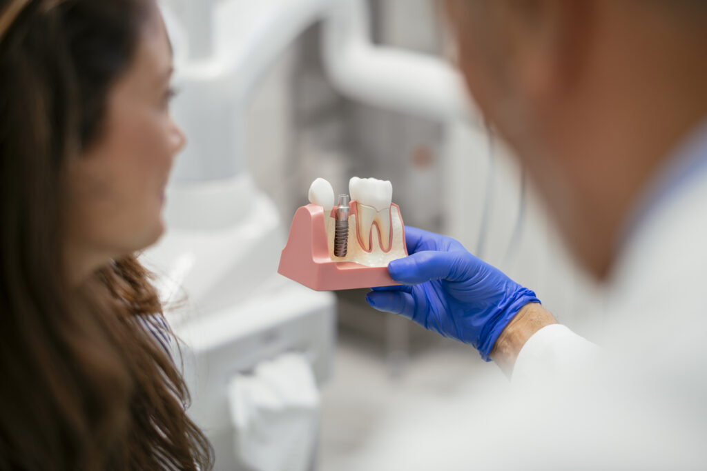 dudas sobre implantes dentales
